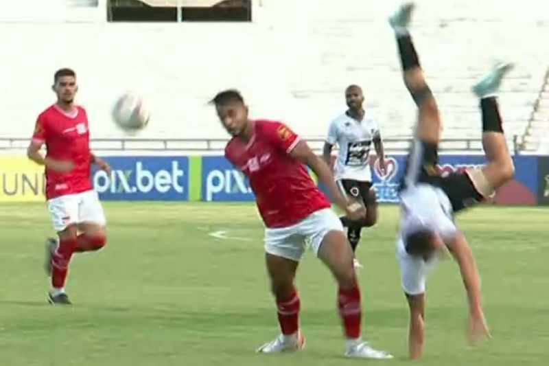 Jogador do Botafogo (PB) sofre grave lesão contra o Auto Esporte e vai passar por cirurgia 6 lesao igor maduro 180125