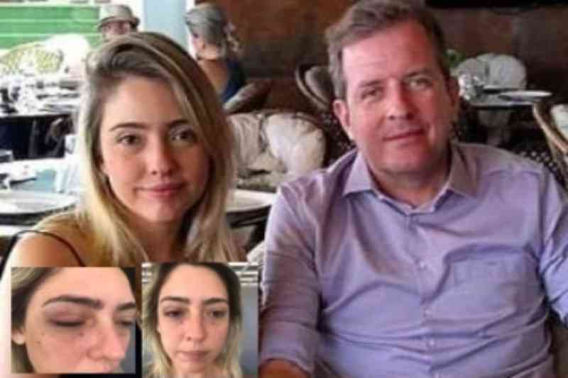 STJ mantém condenação de Fábio Tyrone por agressão à ex-namorada e rejeita recurso da defesa 4 myriam gadelha e fabio tyrone