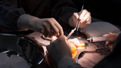 transplante renal hosp mulher